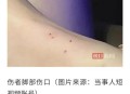每年超25万人被蛇咬,澳大利亚蛇多吗？