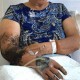 救助眼镜蛇反被咬伤,眼镜蛇咬伤有什么症状？