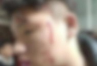 在宿舍内被多人殴打,少年在宿舍遭6人轮流殴打：被逼下跪一声不吭，遇到校园暴力，我们该怎么做？