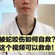 被蛇咬伤网友救命,蛇认出救命恩人的故事？