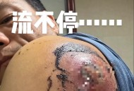 被鲨鱼咬后炫耀伤口,刀口改的大鱼会煮烂嘛？