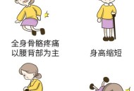 近8成女性骨质疏松,女性骨质疏松比例 近8成女性骨质疏松,女性骨质疏松比例