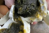 200多枚蛋冲下水道,下水道有臭鸡蛋味是什么原因？