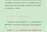 学生体测心源性猝死,心源性猝死有那些临床表现？