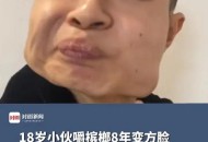 1亿国人在嚼槟榔,我一个东北人，为什么嚼槟榔会上瘾？