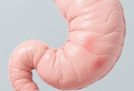 女子胃里现2斤塑料袋,塑料袋在胃里