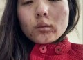 女子拒绝男子被重伤,女子拒绝男子被重伤视频