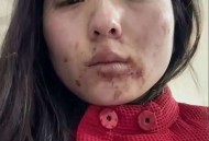女子拒绝男子被重伤,女子拒绝男子被重伤视频
