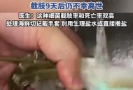 渔民被海鲜刺伤身亡,珠海哪里有渔民卖海鲜？