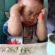 误吞勺子半年后发现,吃勺子会怎么样？