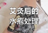 做艾灸致2度烫伤,艾灸不小心把足三里烫伤了，目前长了一圈红疙瘩，继续还是停止？