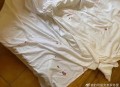 酒店被曝床单有血迹,为什么宾馆床单都有血迹？