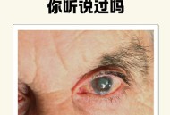 青光眼当感冒险失明,青光眼 感冒