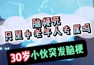 脑梗专家自己脑梗了,脑梗走路腿痉挛挂宣武医院那位专家号？