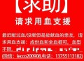 富豪与儿子置换血浆,血浆置换能报销吗？