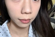 矿泉水里喝出美瞳,矿泉水里喝出美瞳怎么办