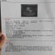 结婚5年未见对方脸,孕期四维检查看不到脸是怎么回事？