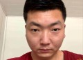 怀疑出轨拔女友8颗牙,
