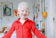 瞒遗传病致女儿患病,范克尼贫血是一种遗传病吗？为什么父母正常，孩子却患病？