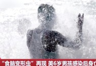 5岁女童感染食脑虫,食脑虫感染几率