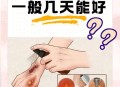 做艾灸致2度烫伤,艾灸烫伤后怎么处理？
