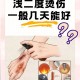 做艾灸致2度烫伤,艾灸烫伤后怎么处理？