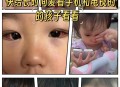 用手机哄孙子致近视,小孩玩了手机游戏一个月眼变近视了？
