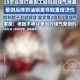 昆明事故致2死9伤,昆明发生事故