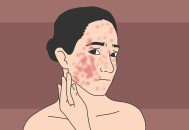 最疼皮肤病高发期,为什么每年春天，人的面部皮肤干裂、褪皮、痒痛？该如何调理？