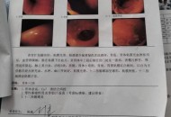 看教程做手术致死亡,我老妈妈早期胃癌在医院做胃全切手术，术后感染导致三天死亡，医院没一点责任吗？