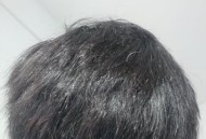 头发开叉其实是病,头发开叉正常吗