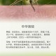 蚊子最爱的7类人,蚊子和人属于什么关系？