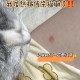 买猫被传染满脸猫藓,猫癣会不会空气传染晒过的衣服，和人？