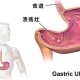 吃羊胎盘染致命细菌,吃羊胎盘染致命细菌吗