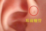 男子剪发耳朵被剪裂,剃头大师闯了祸是指？