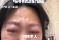 扶老人被诬自证清白,扶了下摔倒的老人反被赖着，有人证证明清白，朋友这时应该怎么办?有叫交警，警察？