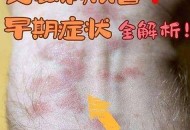 隐瞒艾滋10年无防护,如果有人明知自己有艾滋病却隐瞒，还与他（她）人结婚，那么有没有法律保护健康的一方？