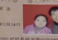 袖珍妈妈生健康男婴,袖珍妈妈生的孩子正常吗