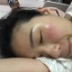 结婚5年未见对方脸,为什么脸上的死皮看不见？