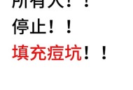 贷款美容店消费91万,脸上的痘坑怎么修复？