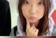 产检正常却长兽皮痣,产检正常却长兽皮痣怎么回事