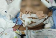 男童被笔扎伤或失明,孩子被笔扎图片视频