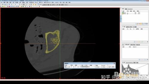 mimics软件教程,mimics软件安装教程 mimics软件教程,mimics软件安装教程