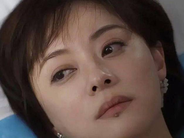 孙俪唇下痣没了,孙俪唇下的是唇钉吗?