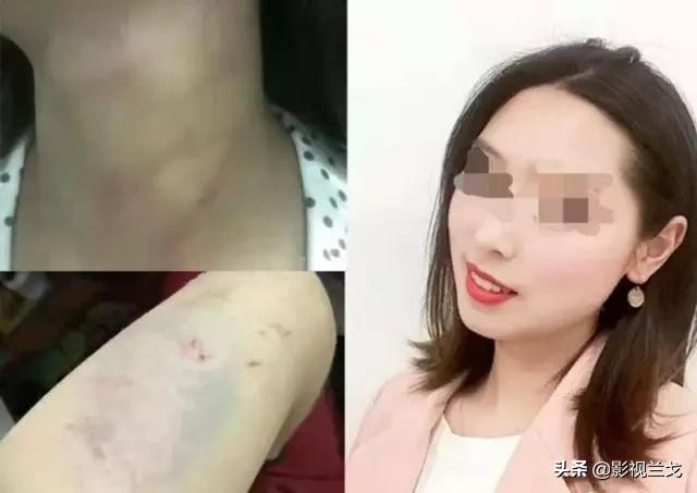 老师从舞台坠落,巴中女教师与丈夫冲突后坠亡，警方称系自杀不立案，家属：已提请检察院、司法局，要求复议，立为刑事案件。你怎么看？