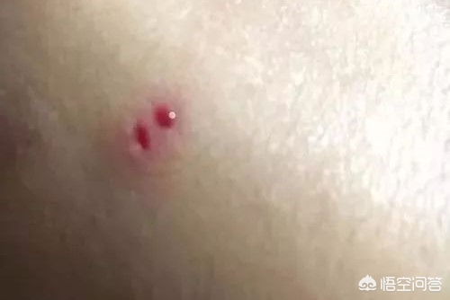 女子遭毒蛇咬伤身亡,女子遭毒蛇咬伤身亡视频