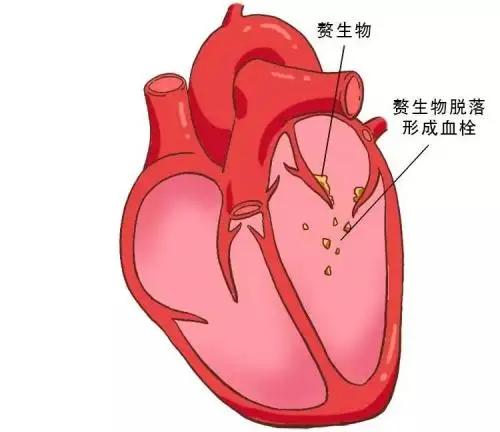 涉事医院多次违规,医院住院涉嫌违规是什么意思? 涉事医院多次违规,医院住院涉嫌违规是什么意思?