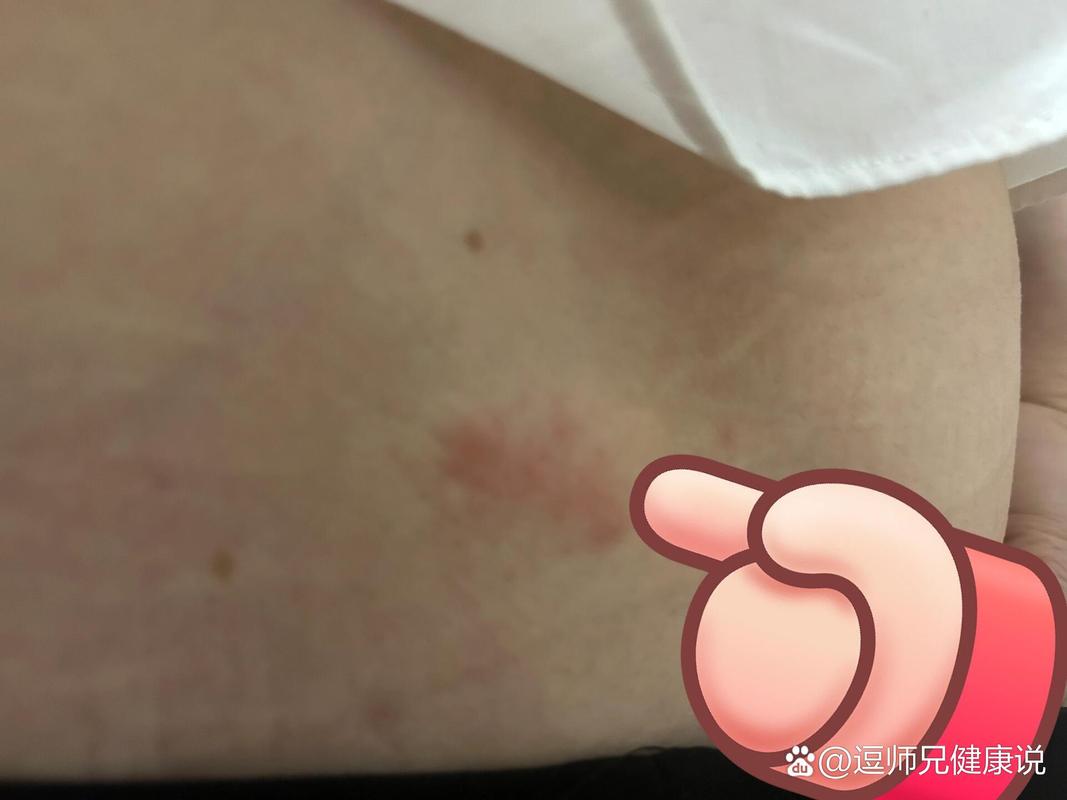 女子遭毒蛇咬伤身亡,女人掉下悬男人救结果被石头砸断了腰蛇在咬女人女人叫放手请是是什么意思?