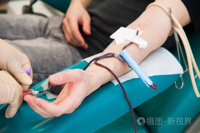要先献血再输血致死,新泰医院输血需要先去献血吗?