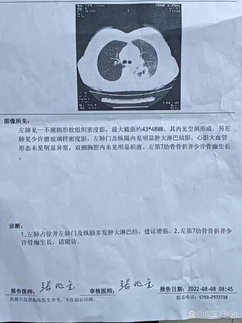 抗癌2年后发现误诊,一个月前在医院查出肺癌,住院后发现被误诊了,我可以告医院吗?